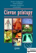 Cievne prístupy